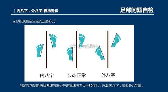 鞋子高帮和低帮影响孩子足踝发育吗?孩子八字脚怎样矫正?