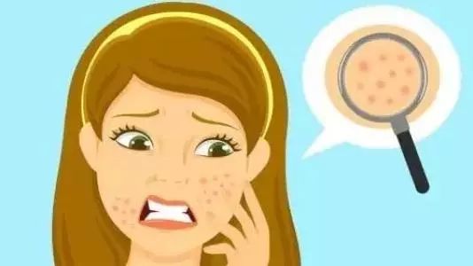 毛孔粗大显老,告别毛孔粗大肤色暗黄