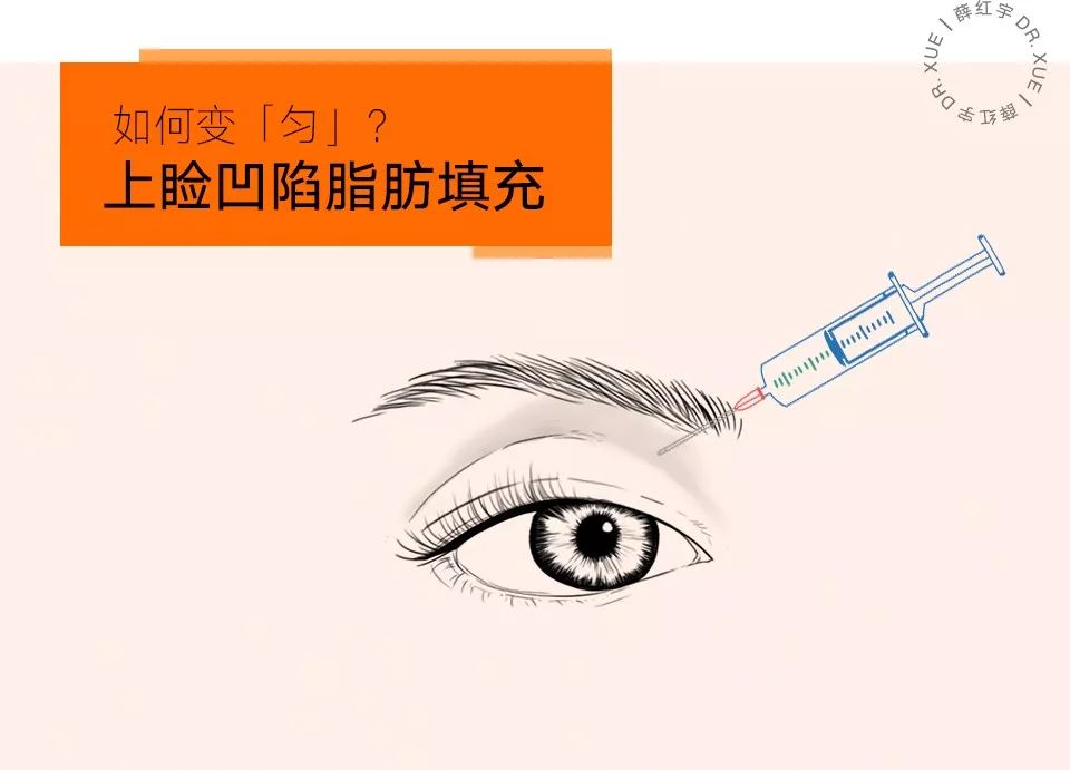 三层眼皮女人的特点,哪种眼皮最好看