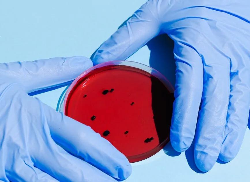 尿液中的健康信号,尿液有什么危险信号