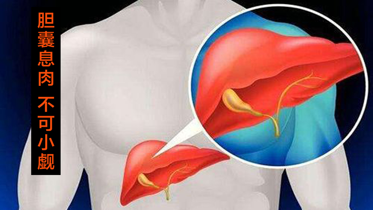 胆囊长息肉怎么治,胆囊上有息肉应该怎么治疗