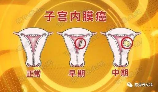 王熙凤血崩是怎么回事,王熙凤的血山崩原因