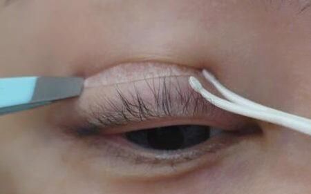 单眼皮怎么贴可以变双眼皮,如何用胶带把单眼皮变成双眼皮