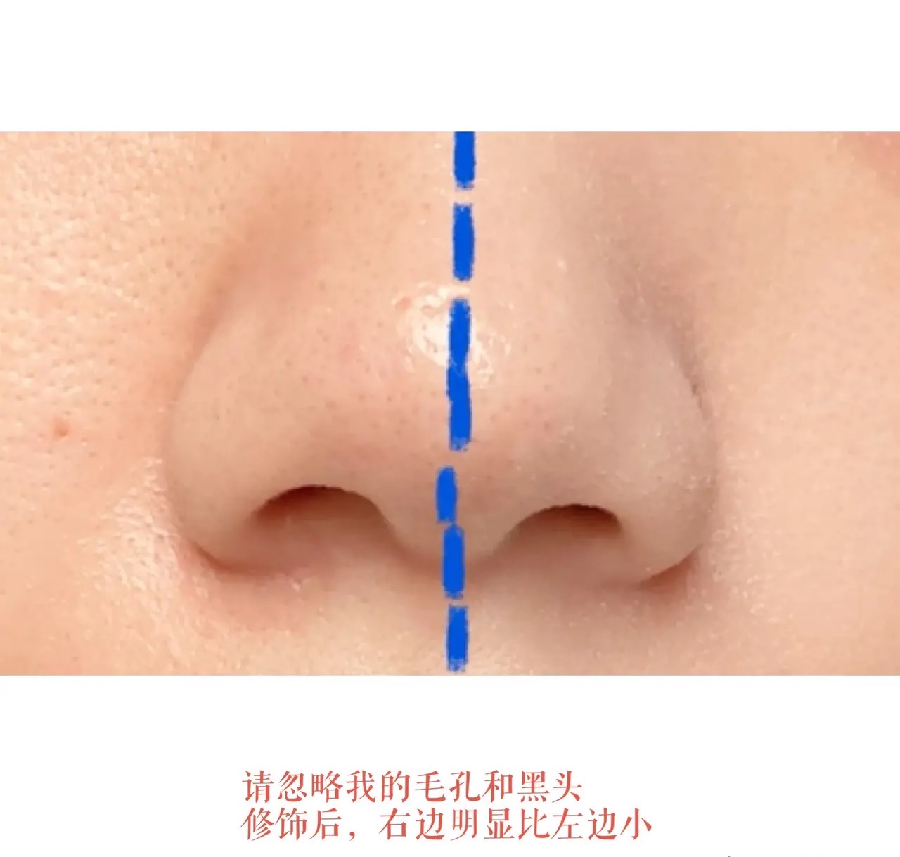 鼻子不好看的人怎么办,鼻子怎么看出来好不好看