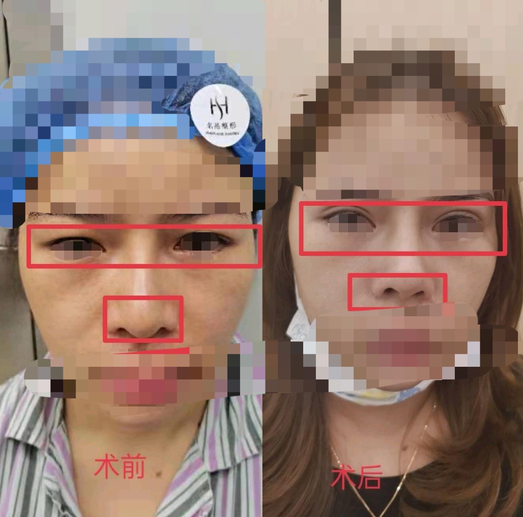 整形效果不满意怎么维权,整形医院不满意退款