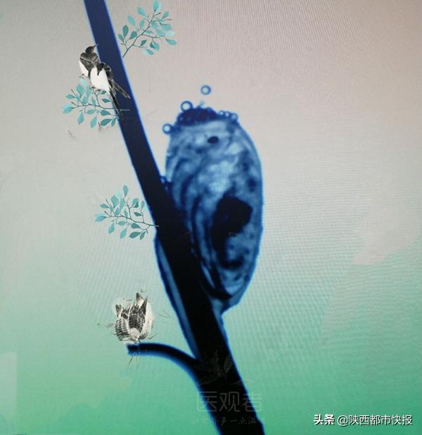 开脑洞！西安一皮肤科博士制作真菌拜年图堪称显微镜下的“表情包”