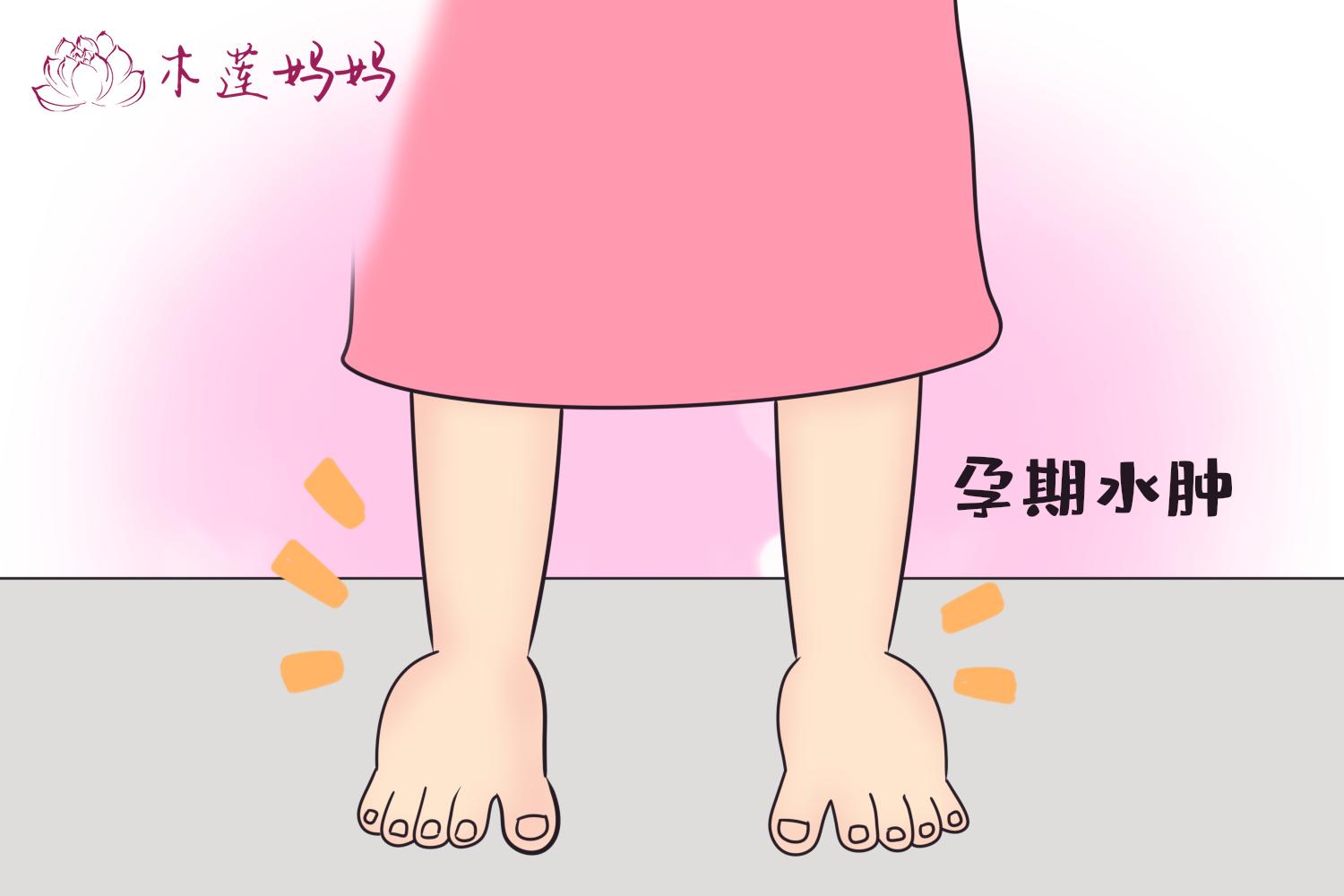 孕期水肿是肾不好吗,孕期浮肿有什么办法缓解