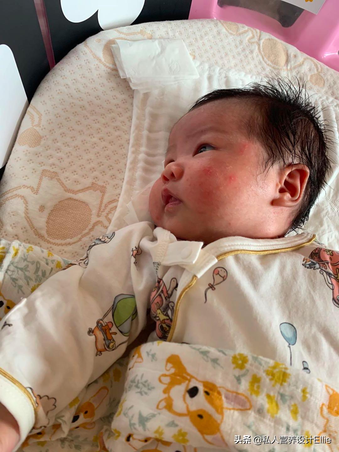 月子餐如何防止宝宝胀气腹泻,月子里宝妈出现湿疹忌口