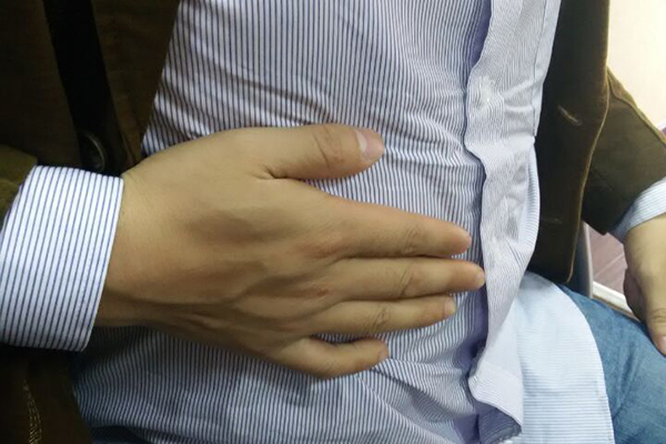 致癌细菌会传染哪些疾病,癌症要怎么注意防范传染