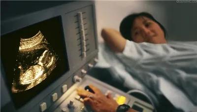 容易让人忽视的妇科检查你做了吗,什么情况下可以不用做妇科检查