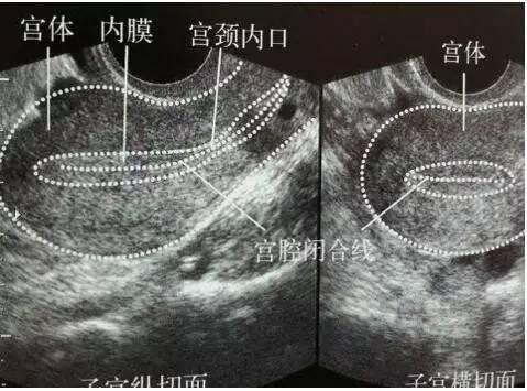 连续流产好几次了，检查说是单角子宫畸形