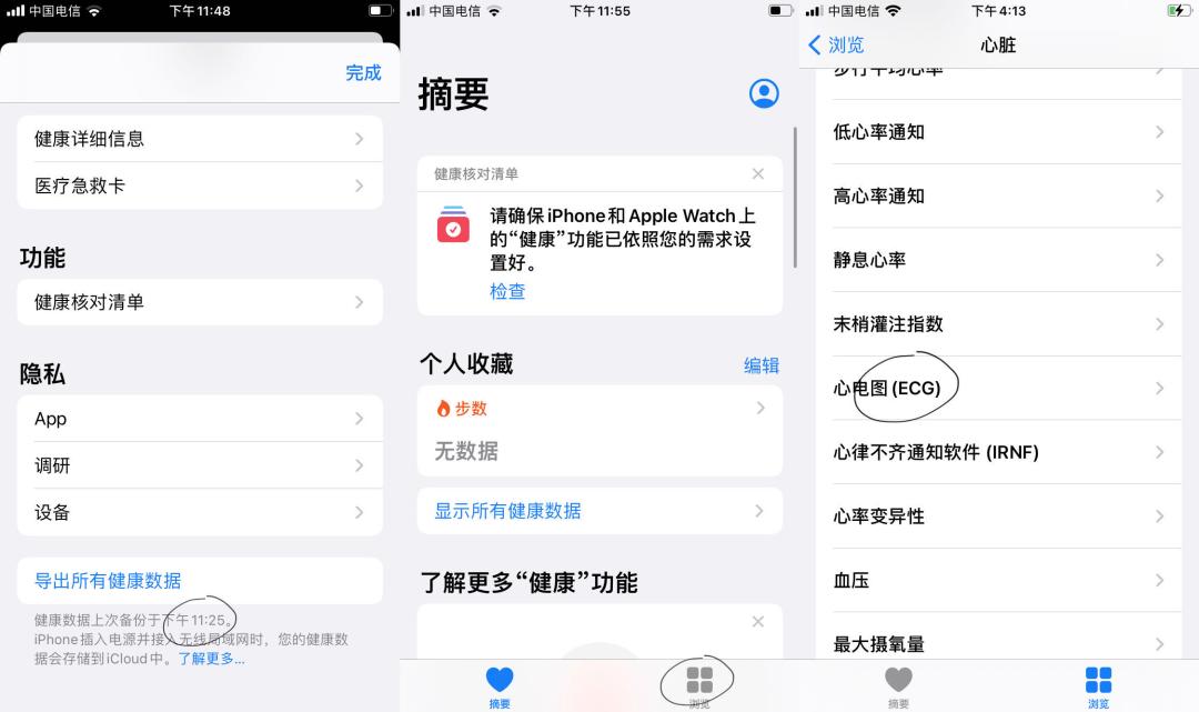 applewatch心电图激活教程,苹果ecg心电图激活