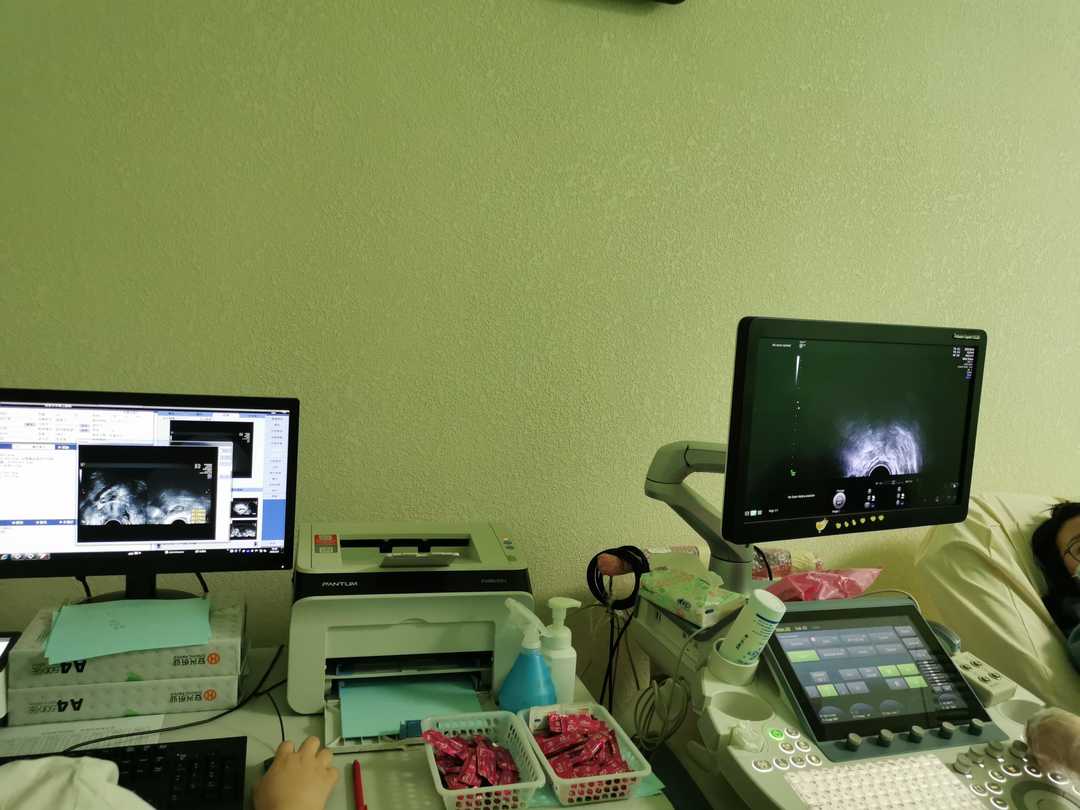 妇科超声前准备,妇科超声知识讲解