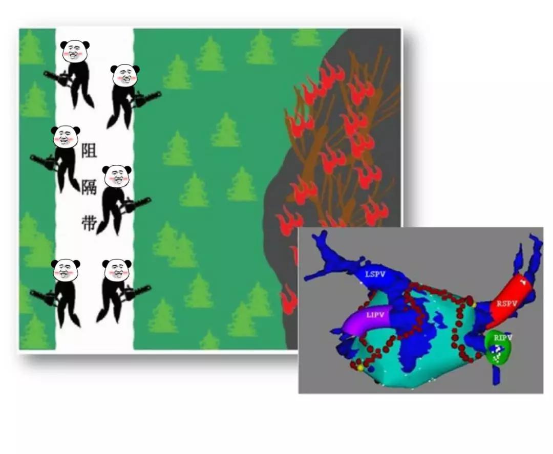 冷冻消融术治疗房颤,冰与火的对抗视频