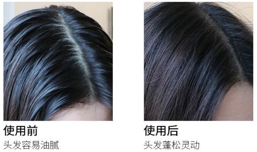 控油好不伤头皮的好洗发水,为什么有的洗发水用了头皮特别多