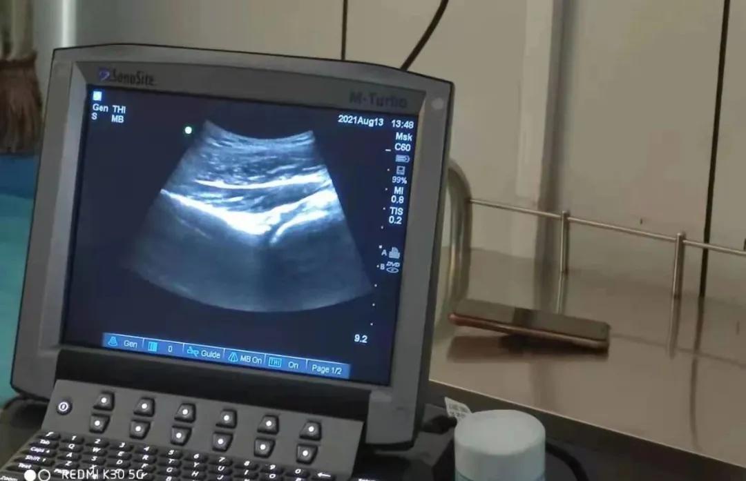 「你是我的眼」——记超声引导下精准疼痛治疗