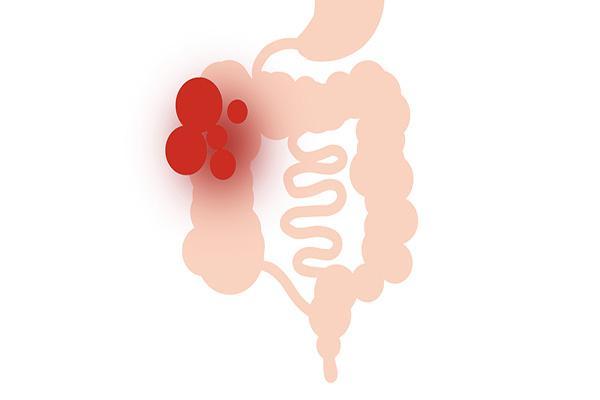 天凉容易拉肚子是什么原因中医,为什么一吃冷的就跑肚