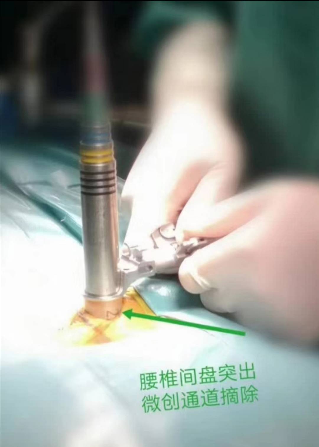 牙齿不好引发的疾病视频,牙齿有问题不做根管治疗会怎么样