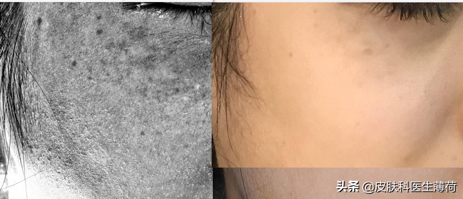 看图识皮肤病,看图识病是什么病