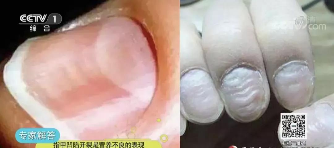 快低头看看你的手指属于什么样的,看一看你的手指是哪个类型的