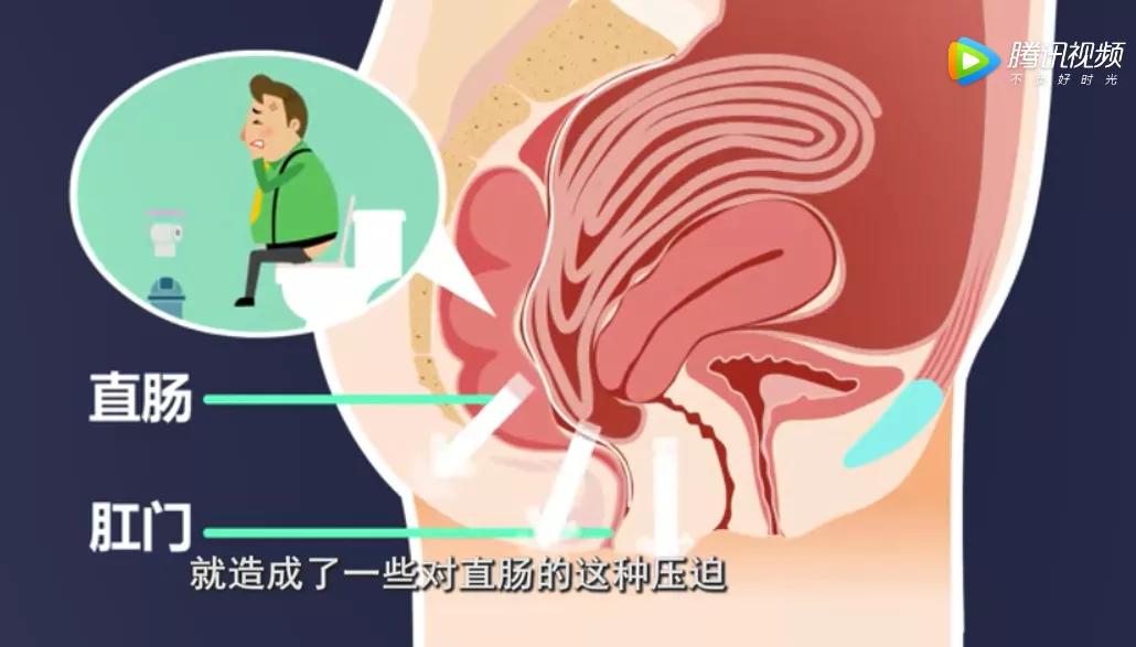 腹部胀气便秘怎样治,便秘容易引起腹部疝气吗