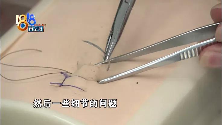 医术精湛的医生,医术非常高超的医生