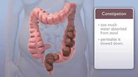 肛肠痔瘘的症状有哪些,痔疮肛裂肛窦炎怎么治