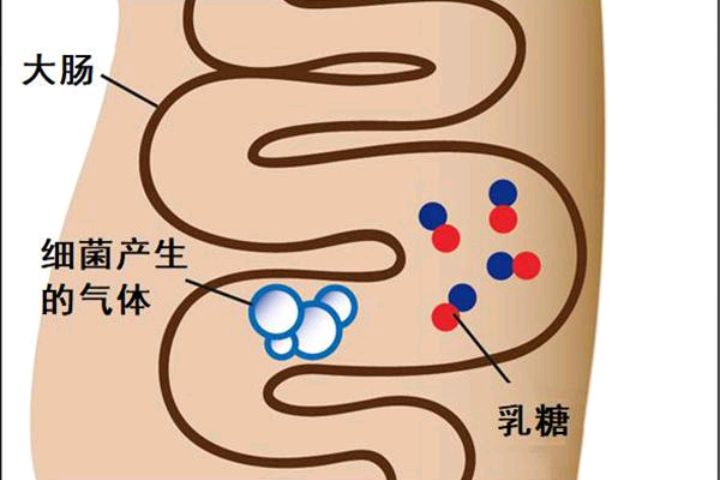 喝牛奶腹泻是乳糖不耐受吗,喝牛奶引起的腹泻是肠炎吗