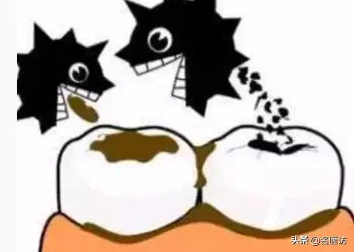 小孩乳牙龋齿要治么,小孩乳牙龋齿了需要治疗么