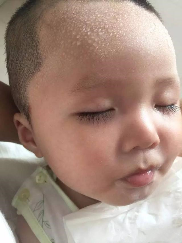 小孩子爱出虚汗需要补锌吗,宝宝出虚汗是缺锌还是缺钙