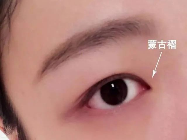 日本双眼皮整形视频,日本整容大师演示