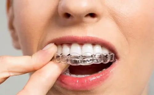 传统矫正pk隐形矫正,牙齿隐形矫正和固定矫正的利弊