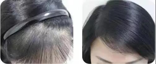 能让头发乌黑靓丽的洗发用品,用什么洗发水能让头发浓密乌黑