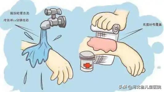 听说有人在伤口处抹酱（xiā）油（zhěng）