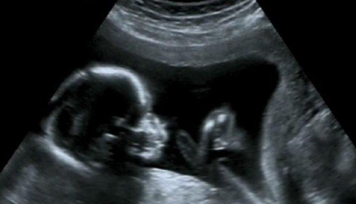 孕妇做b超胎儿在开车视频,b超胎儿开车