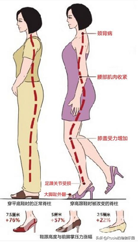 膝盖疼穿高跟鞋反倒好些了,穿高跟鞋是否会对踝关节有影响