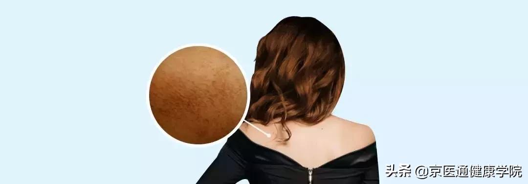 顽固湿疹痘痘,痘痘湿疹肌肤怎么改善