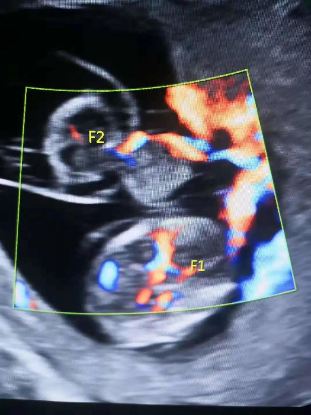 来说吧,来说天津话