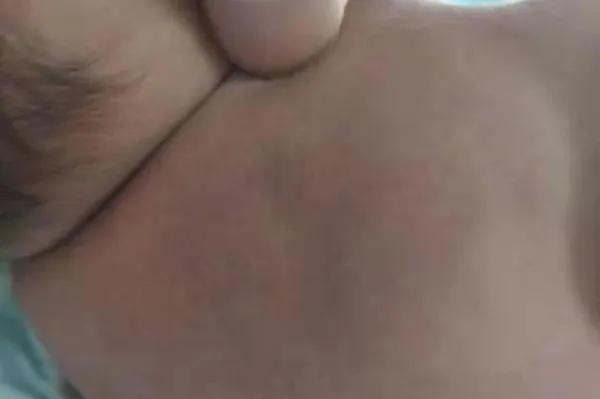 卡梅综合征说明什么,卡梅现象与卡梅综合征