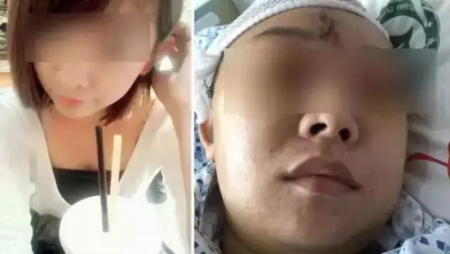 外面小作坊整容“车祸”太闹心,深圳公立医院请来英国最牛“外貌协会”