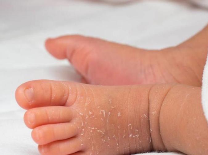 新生儿肚皮鼓起来正常吗,新生儿肚皮鼓还硬硬的