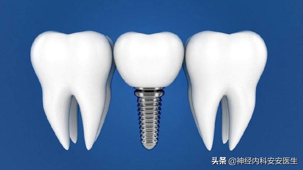 种植牙究竟是怎样的？是播种后再长出新牙齿吗？有哪些优缺点呢？
