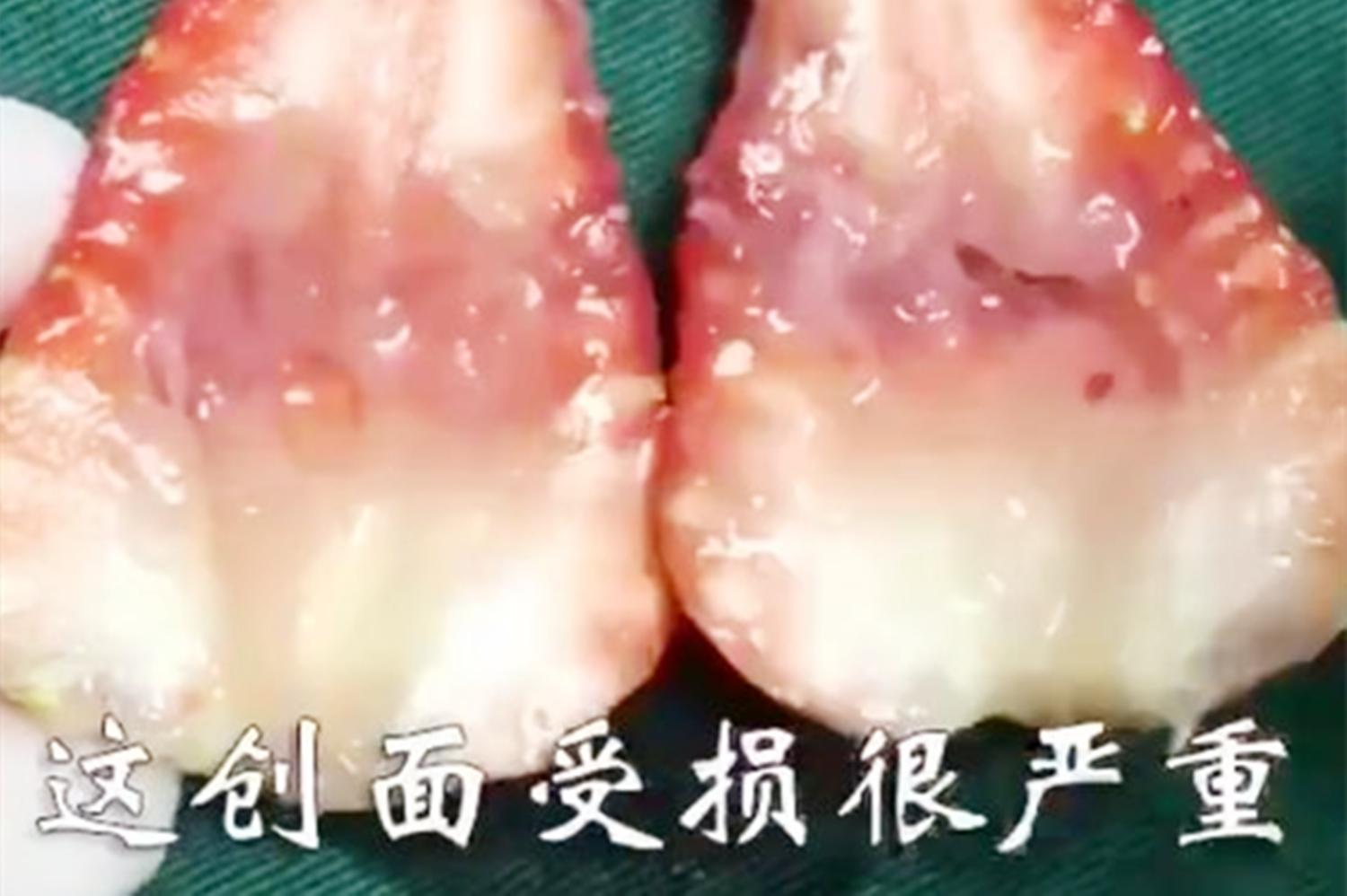 胎儿有了心跳孕妇会有反应吗,胎儿心率过快能直接引产吗