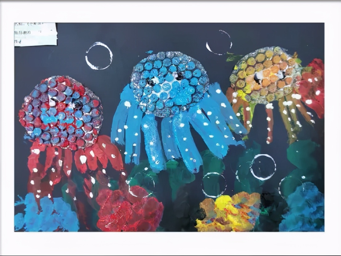 洗澡时发现左大腿包块四个月的女儿成为科室最小的患癌儿童