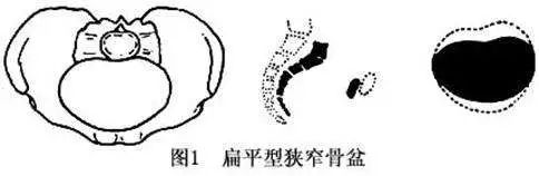 难产一次再次怀孕需要注意什么,难产有哪些内容