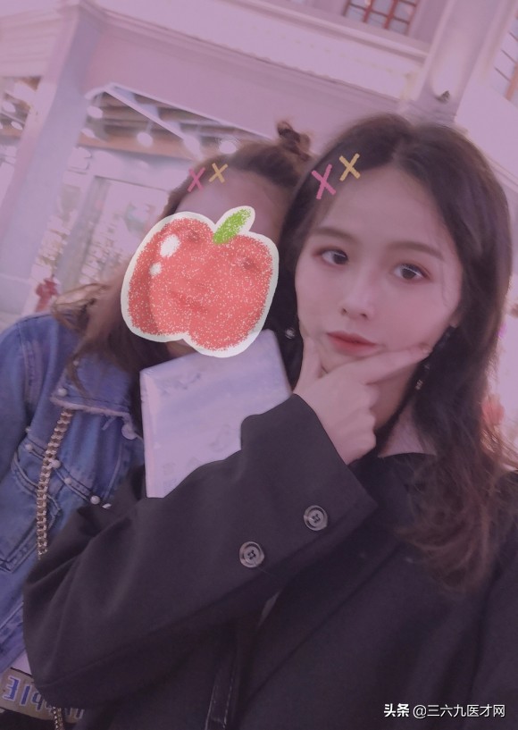 龅牙矫正成功的图片对比,2周岁龅牙可以矫正吗