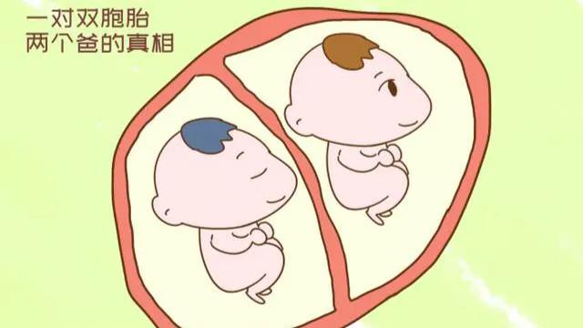 一对双胞胎同母不同爹亲子鉴定,双胞胎兄妹亲子鉴定出结果了