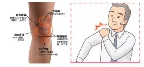 赶走疼痛，一身轻松！腰背痛，太原市中心医院疼痛科有妙招