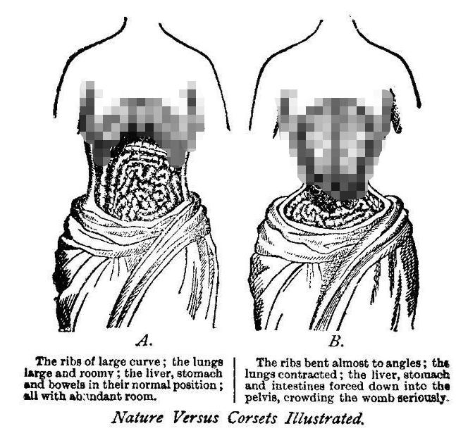 【魔幻时尚史】束腰：堪比刑具的变美工具