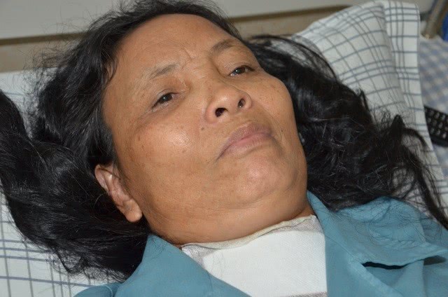 越南花季少女患癌症,越南女子身患癌症